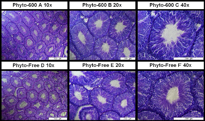 Phytoestrogens Effects on Male Sexual Health Parameters